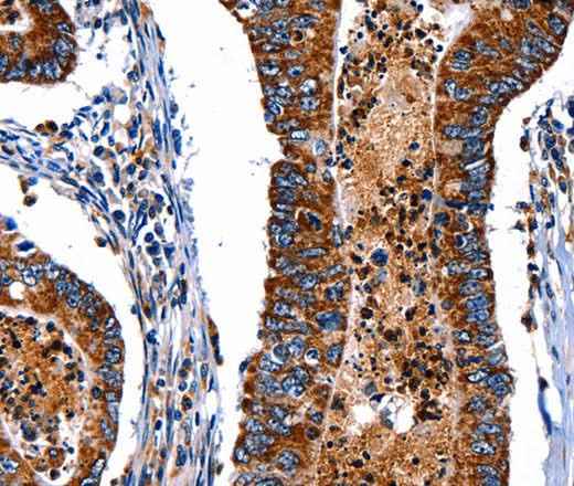 Anti-Human/Mouse/Rat ITGA7 Antibody