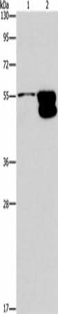 Anti-Human/Mouse/Rat CRHR2 Antibody - ABMIUM