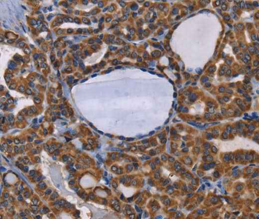 Anti-Human/Rat ADRBK2 Antibody