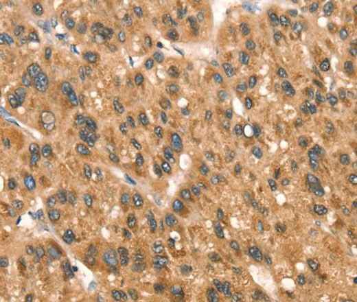 Anti-Human/Mouse/Rat DAP Antibody