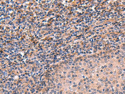 Immunohistochemistry of paraffin-embedded Human tonsil tissue using ARIH2 Polyclonal Antibody at dilution of 1:70(×200)