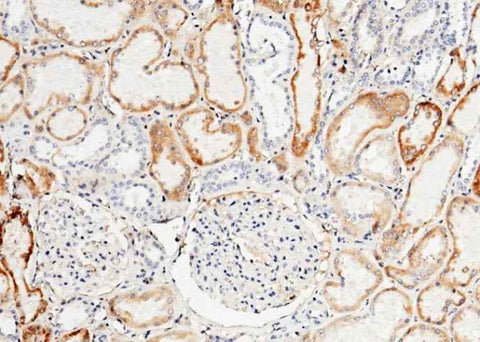 Anti-Human TFPI Antibody [B115] - ABMIUM