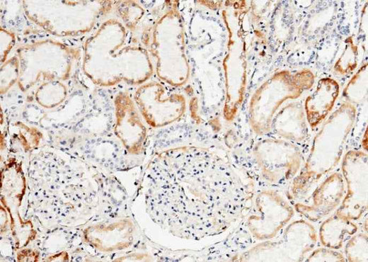 Anti-Human TFPI Antibody [B115] - ABMIUM