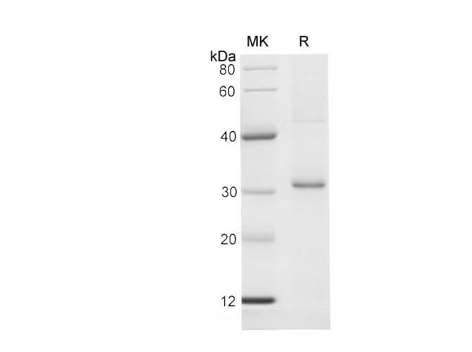 SDS-PAGE analysis of Human NFATC4 proteins, 2 μg/lane of Recombinant Human NFATC4 proteins was resolved with SDS-PAGE under reducing conditions, showing bands at 31-33 kDa.