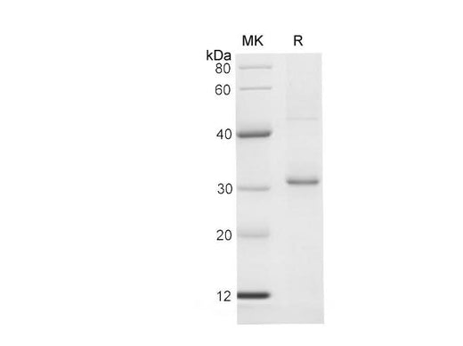 SDS-PAGE analysis of Human NFATC4 proteins, 2 μg/lane of Recombinant Human NFATC4 proteins was resolved with SDS-PAGE under reducing conditions, showing bands at 31-33 kDa.