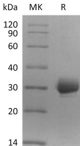 Recombinant Human CCDC134 Protein (His Tag) - ABMIUM