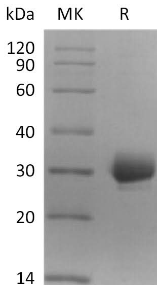 Recombinant Human CCDC134 Protein (His Tag) - ABMIUM