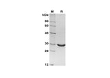 SDS-PAGE analysis of Bovine Angiopoietin-2/ANG2 proteins, 2 μg/lane of Recombinant Bovine Angiopoietin-2/ANG2 proteins was resolved with SDS-PAGE under reducing conditions, showing bands at 28 kDa.