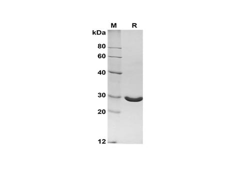 SDS-PAGE analysis of Bovine Angiopoietin-2/ANG2 proteins, 2 μg/lane of Recombinant Bovine Angiopoietin-2/ANG2 proteins was resolved with SDS-PAGE under reducing conditions, showing bands at 28 kDa.