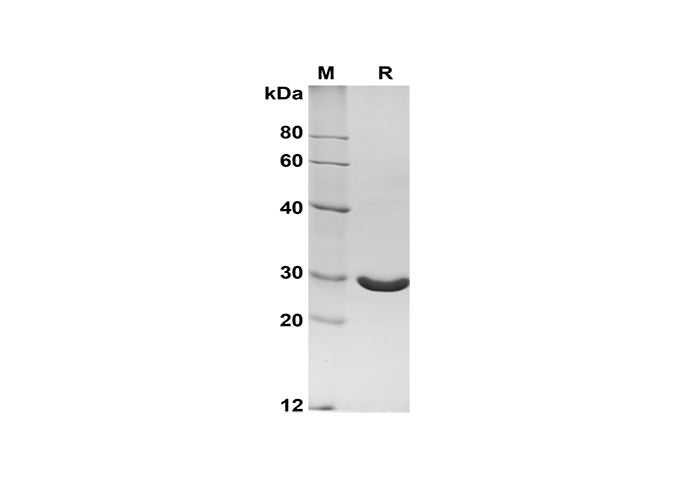 SDS-PAGE analysis of Bovine Angiopoietin-2/ANG2 proteins, 2 μg/lane of Recombinant Bovine Angiopoietin-2/ANG2 proteins was resolved with SDS-PAGE under reducing conditions, showing bands at 28 kDa.