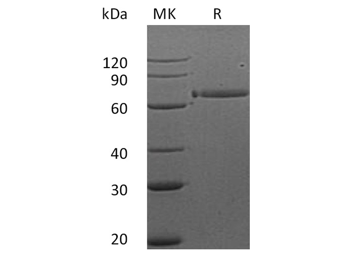 Recombinant Human HER3/ErbB3 Protein (Fc Tag) - ABMIUM