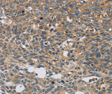 Anti-Human/Mouse STAT4 Antibody - ABMIUM