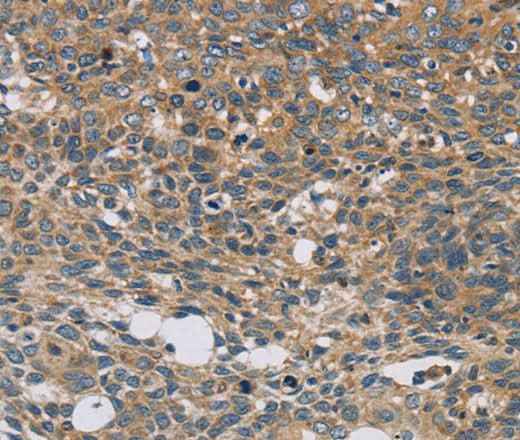 Anti-Human/Mouse STAT4 Antibody