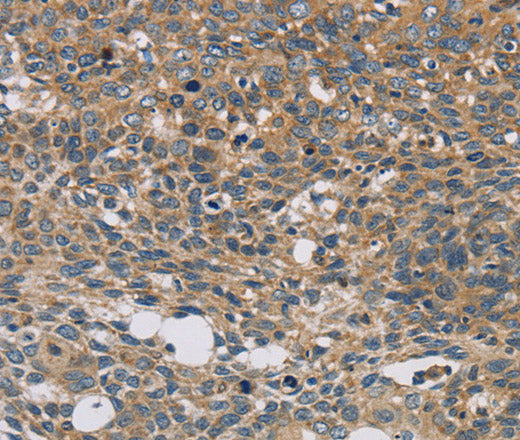 Anti-Human/Mouse STAT4 Antibody - ABMIUM
