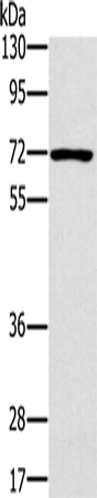 Anti-Human/Mouse/Rat PLS3 Antibody - ABMIUM