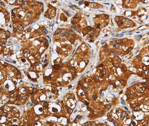 Anti-Human/Mouse/Rat GGCX Antibody