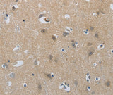 Anti-Human/Mouse/Rat NPR1 Antibody - ABMIUM