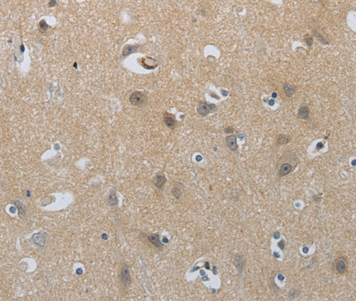 Anti-Human/Mouse/Rat NPR1 Antibody - ABMIUM