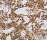 Anti-Human IL18R1 Antibody - ABMIUM