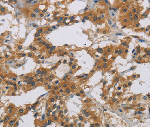 Anti-Human IL18R1 Antibody - ABMIUM