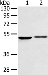 Anti-Human/Mouse/Rat BMP4 Antibody - ABMIUM