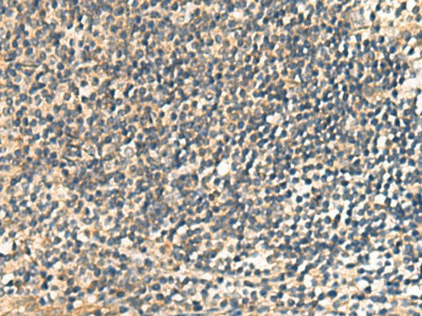 Immunohistochemistry of paraffin-embedded Human tonsil tissue using CNST Polyclonal Antibody at dilution of 1:60(×200)