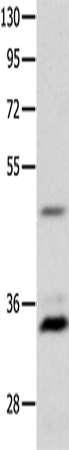 Anti-Human/Mouse MC1R Antibody - ABMIUM