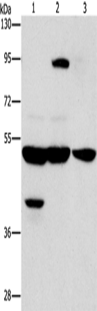 Anti-Human/Mouse STK3/STK4 Antibody - ABMIUM