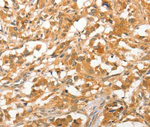 Anti-Human/Mouse/Rat APTX Antibody