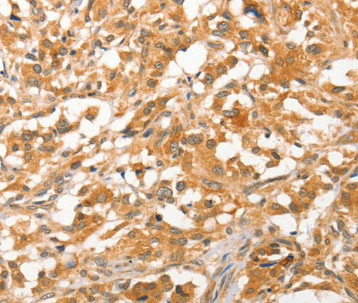 Anti-Human/Mouse/Rat APTX Antibody - ABMIUM