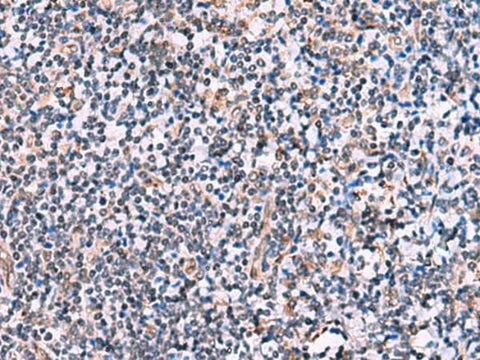 Immunohistochemistry of paraffin-embedded Human tonsil tissue using NMRK2 Polyclonal Antibody at dilution of 1:55(×200)