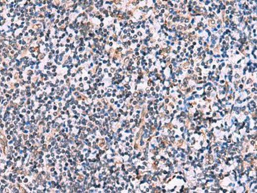 Immunohistochemistry of paraffin-embedded Human tonsil tissue using NMRK2 Polyclonal Antibody at dilution of 1:55(×200)