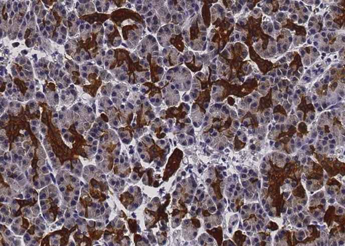 Anti-Human EFNA1 Antibody [B274] - ABMIUM