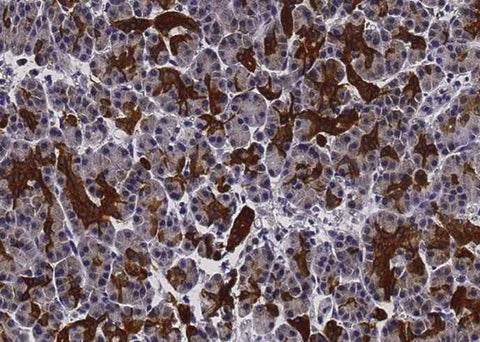 Anti-Human EFNA1 Antibody [B274] - ABMIUM