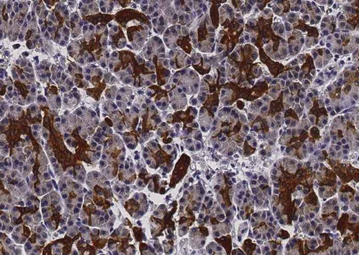 Anti-Human EFNA1 Antibody [B274] - ABMIUM