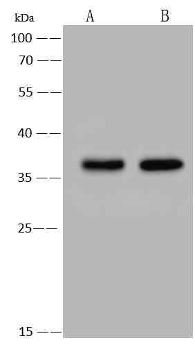 Anti-Human TNFSF11 Antibody [B158] - ABMIUM