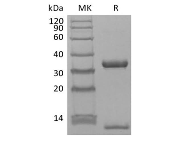 Recombinant Human FcRn & B2M Heterodimer (C-6His-Avi) Biotinylated - ABMIUM