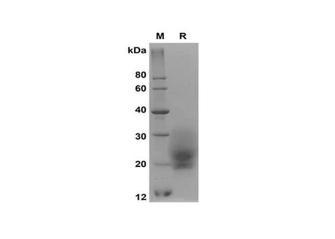 SDS-PAGE analysis of Mouse GM-CSF proteins, 2 μg/lane of Recombinant Mouse GM-CSF proteins was resolved with SDS-PAGE under reducing conditions, showing bands at 20-30 kDa.