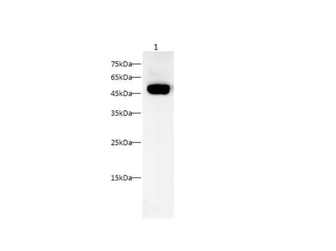 Anti-Human/Rat Osteopontin/OPN Antibody - ABMIUM