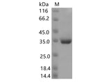 Recombinant SARS-CoV-2 Spike RBD(P499R)(His Tag) - ABMIUM