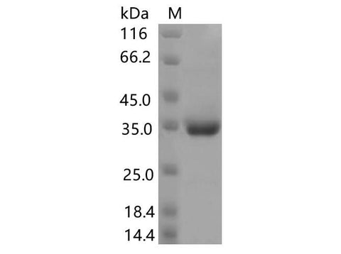 Recombinant SARS-CoV-2 Spike RBD(P499R)(His Tag) - ABMIUM