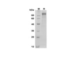 SDS-PAGE analysis of Mouse G-CSF R/CD114 proteins, 2 μg/lane of Recombinant Mouse G-CSF R/CD114 proteins was resolved with SDS-PAGE under reducing conditions, showing bands at 90-100 kDa.