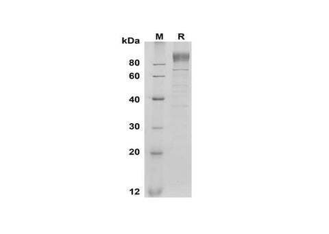 SDS-PAGE analysis of Mouse G-CSF R/CD114 proteins, 2 μg/lane of Recombinant Mouse G-CSF R/CD114 proteins was resolved with SDS-PAGE under reducing conditions, showing bands at 90-100 kDa.