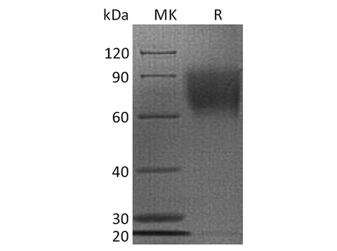Recombinant Human CD30/TNFRSF8 Protein (His Tag) - ABMIUM