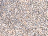 Immunohistochemistry of paraffin-embedded Human tonsil tissue using GIMAP2 Polyclonal Antibody at dilution of 1:55(×200)