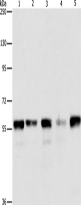 Anti-Human/Mouse ARIH2 Antibody - ABMIUM