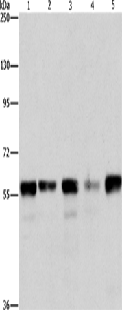Anti-Human/Mouse ARIH2 Antibody - ABMIUM