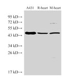 Western Blot analysis of 1)A431, 2)Rat heart, 3)Mouse heart using SERPINB2 Polyclonal Antibody at dilution of 1:1000