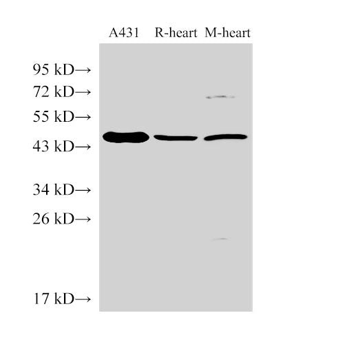 Western Blot analysis of 1)A431, 2)Rat heart, 3)Mouse heart using SERPINB2 Polyclonal Antibody at dilution of 1:1000