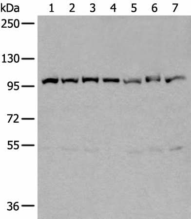 Western blot analysis of 231 Hela A549 A431 HEPG2 Jurkat and K562 cell lysates using VCP Polyclonal Antibody at dilution of 1:400